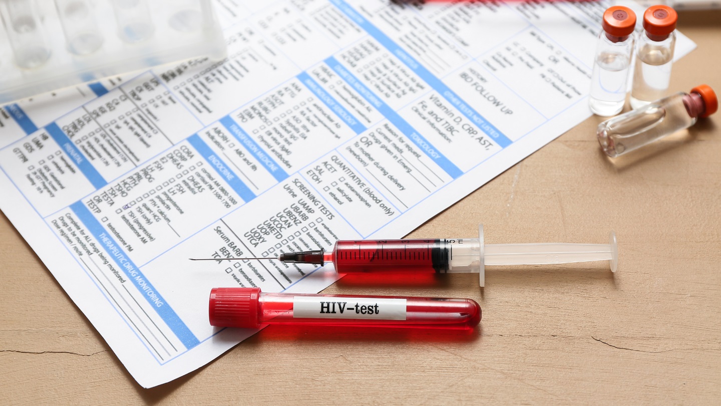 Xét nghiệm HIV AB test nhanh có chính xác không?