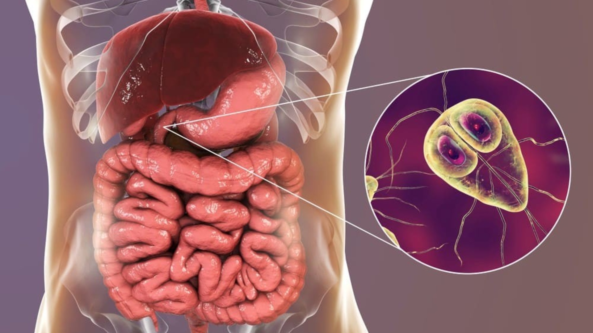 Ký sinh trùng đường ruột là gì? Cách phòng ngừa hiệu quả