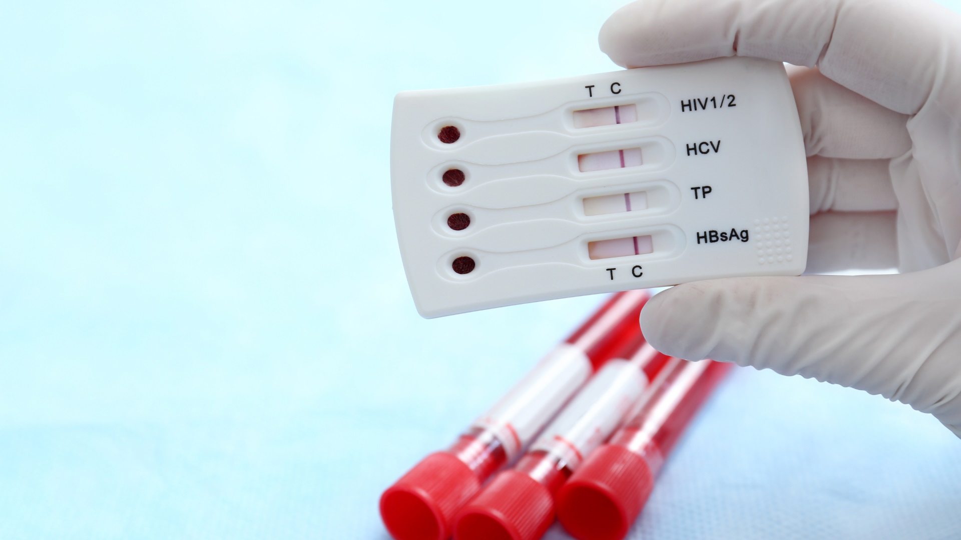 Xét nghiệm HIV tại nhà và những điều bạn cần biết